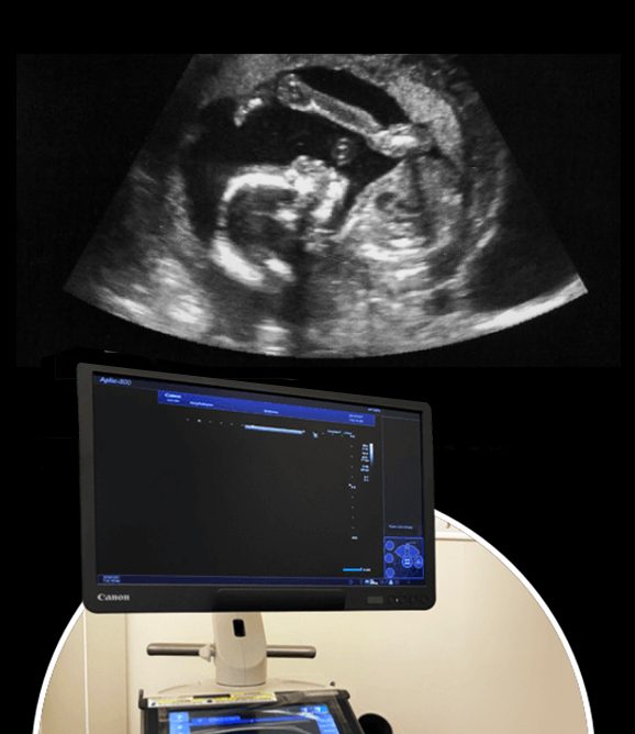 Diagnostic Ultrasound for Mom and Baby