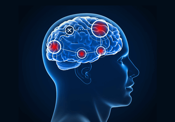 Brain Neuroplasticity