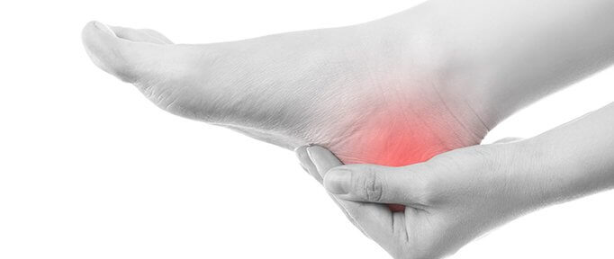 Plantar Fasciitis and Heel Pain - Causes and  Treatment Options