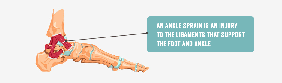 ankle sprain is an injury to the ligaments