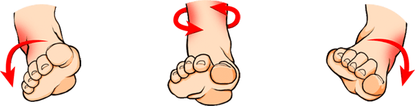 Types of ankle sprains