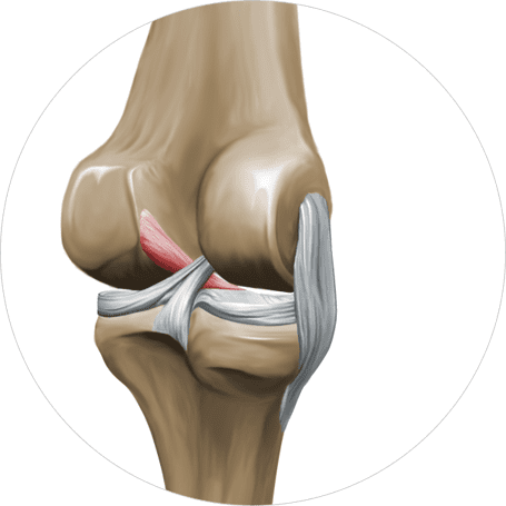 anterior cruciate ligament photo