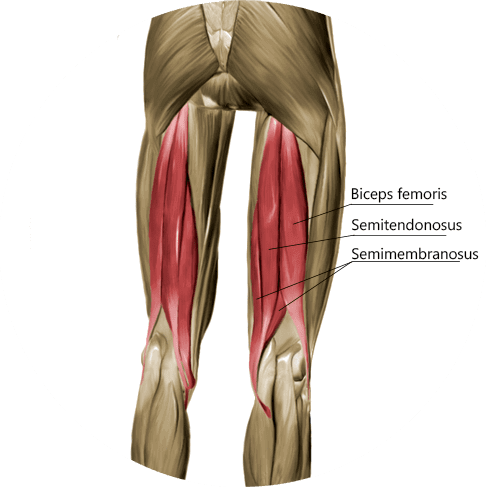 Hamstring Tendon Strain