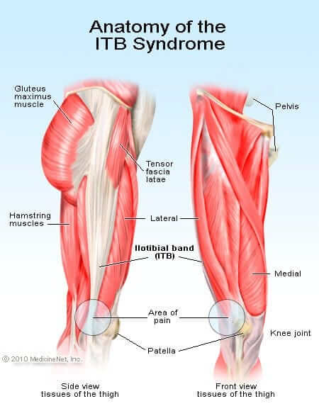IT Band Syndrome in Runners - BenchMark Physical Therapy