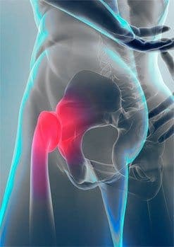 Lower Back Pain Injury can cause hip pain