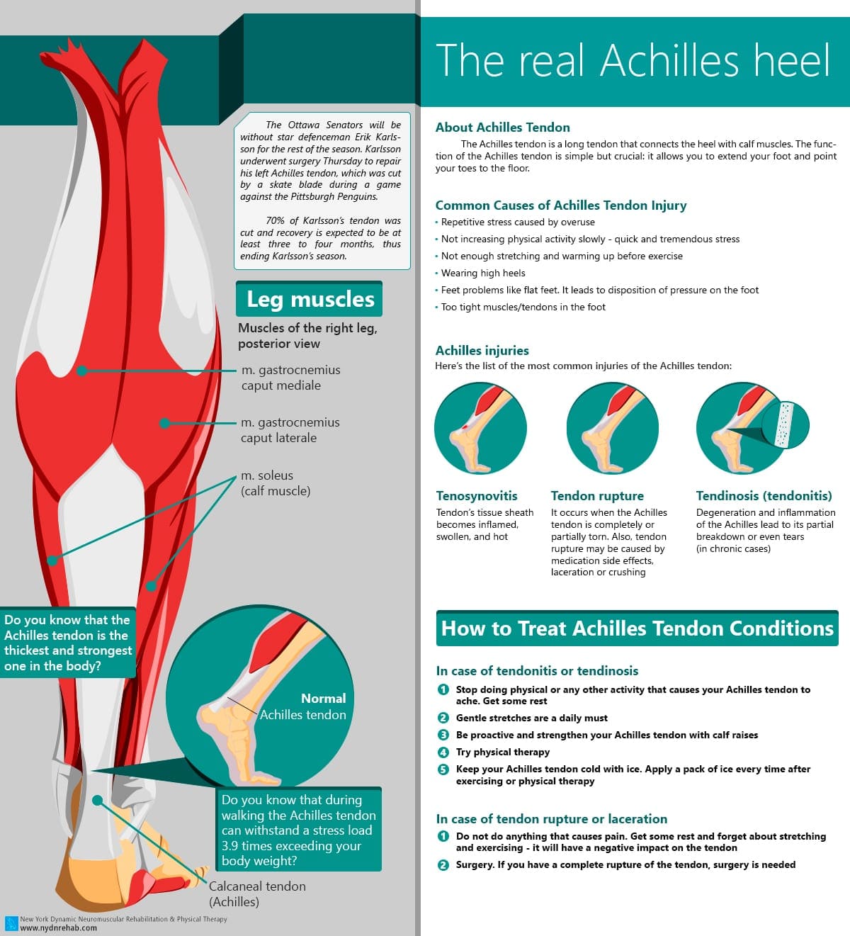 tight achilles tendon treatment