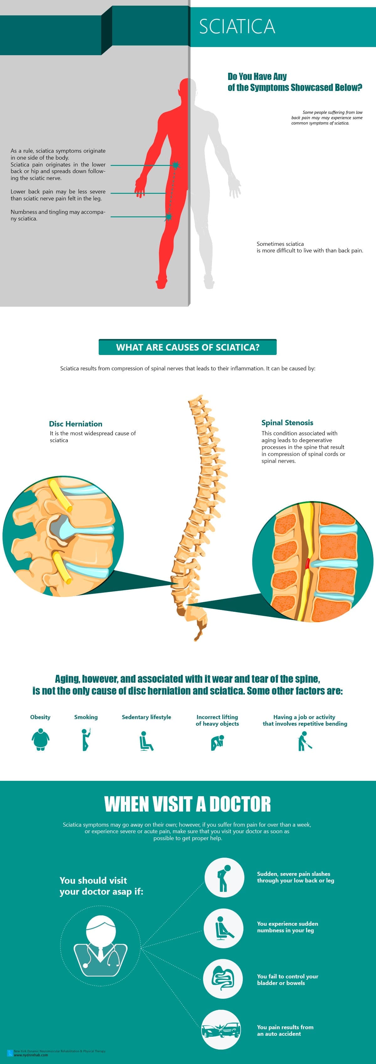 https://nydnrehab.com/wp-content/uploads/2015/07/Sciatica.jpg