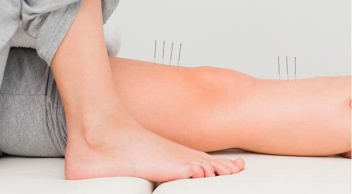 Acupuncture Proves Useful in Treating Foot Pain