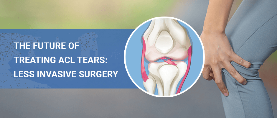 The Future Of Treating ACL Tears: Less Invasive Surgery