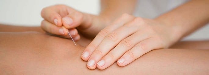 Acupuncture-Seen-as-Viable-Supplement-in-Treating-Osteoarthritis