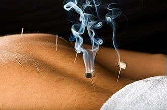 Cold Weather and Joint Pain: Acupuncture and Chinese Medicine for Relief