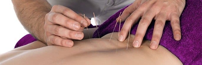 Acupuncture for low back pain