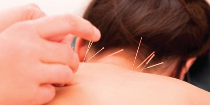 Acupuncture and Neck Stiffness