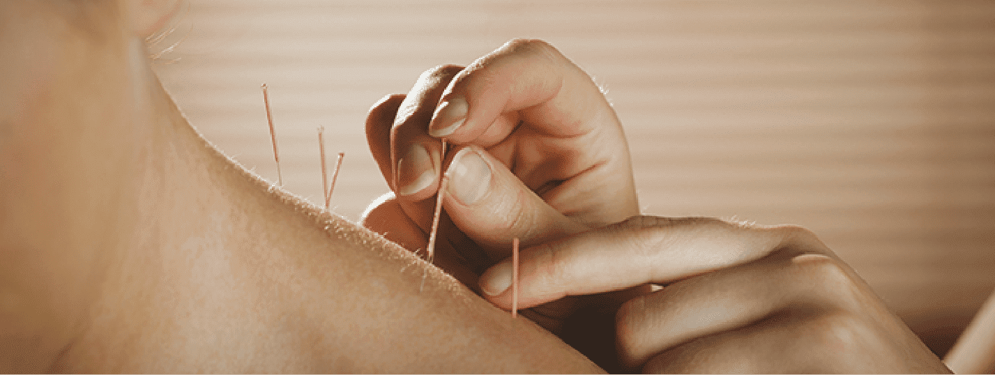 Acupuncture Can Provide Neck Pain Relief