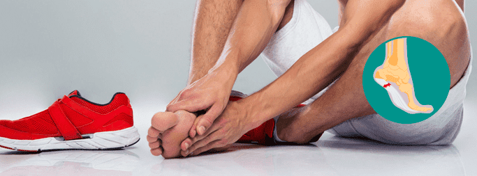 Everything You Need to Know About Plantar Fasciitis