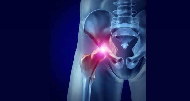 Hip Flexor Pain