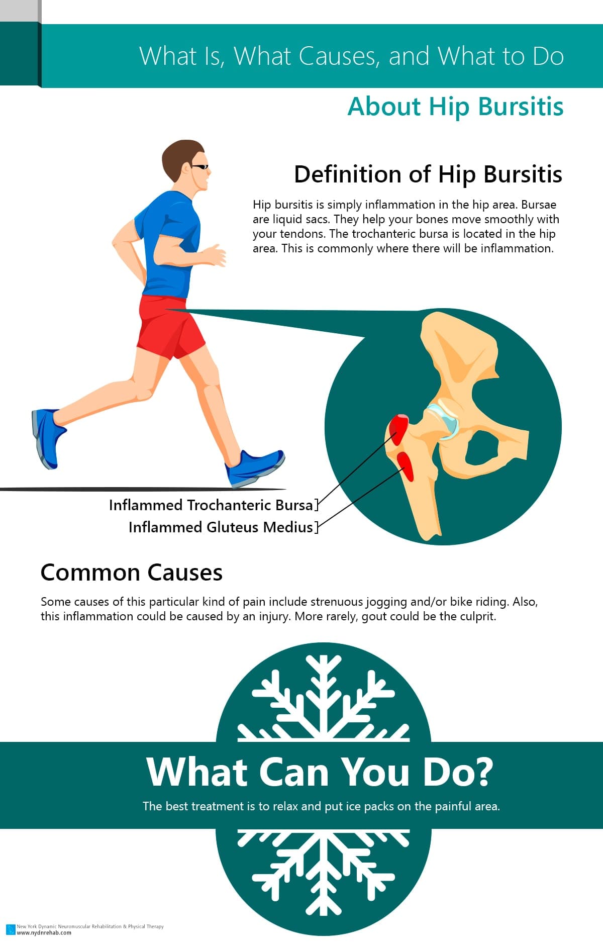 What Is, What Causes, and What to Do About Hip Bursitis