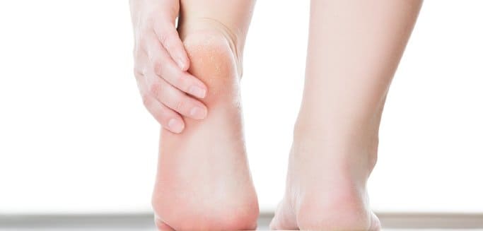 Diagnosis-and-Treatment-of-Plantar-Fasciitis-Heel-Pain