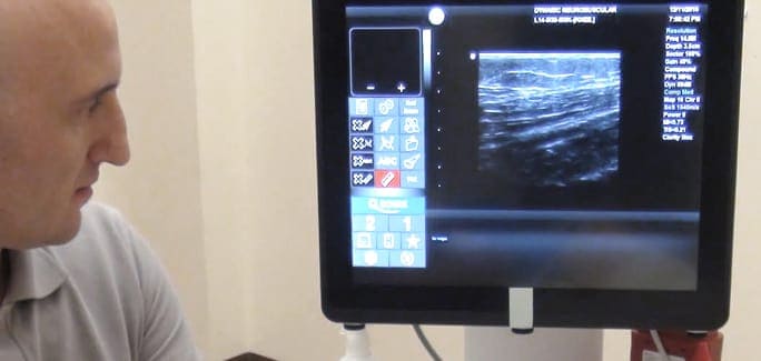 10-Reasons-Ultrasound-Imaging-beats-MRI-and-Xray-for-Diagnosing-and-Treating-Musculoskeletal-Conditions