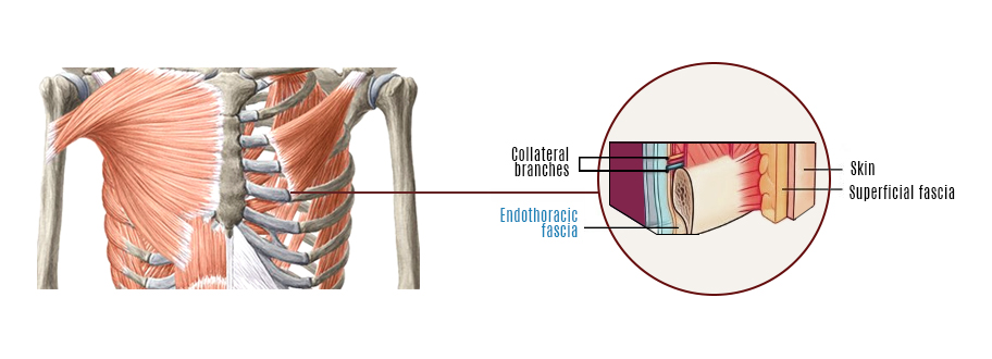 Role of Fascia in Rib Cage Pain