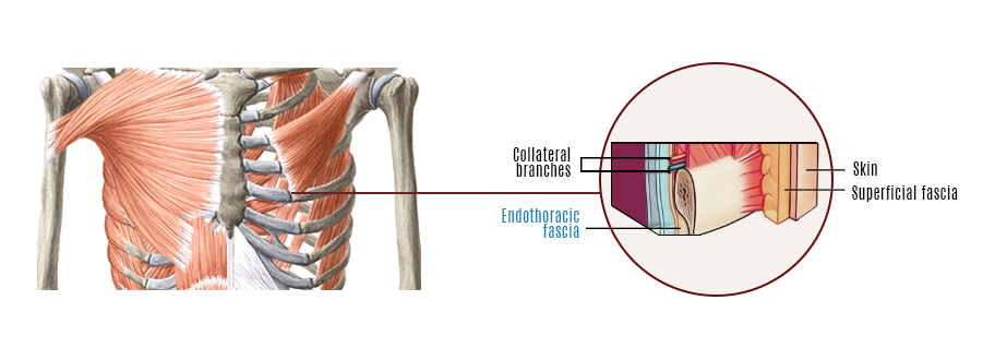 Getting To The Bottom Of Rib Cage Pain Nydnrehab Com