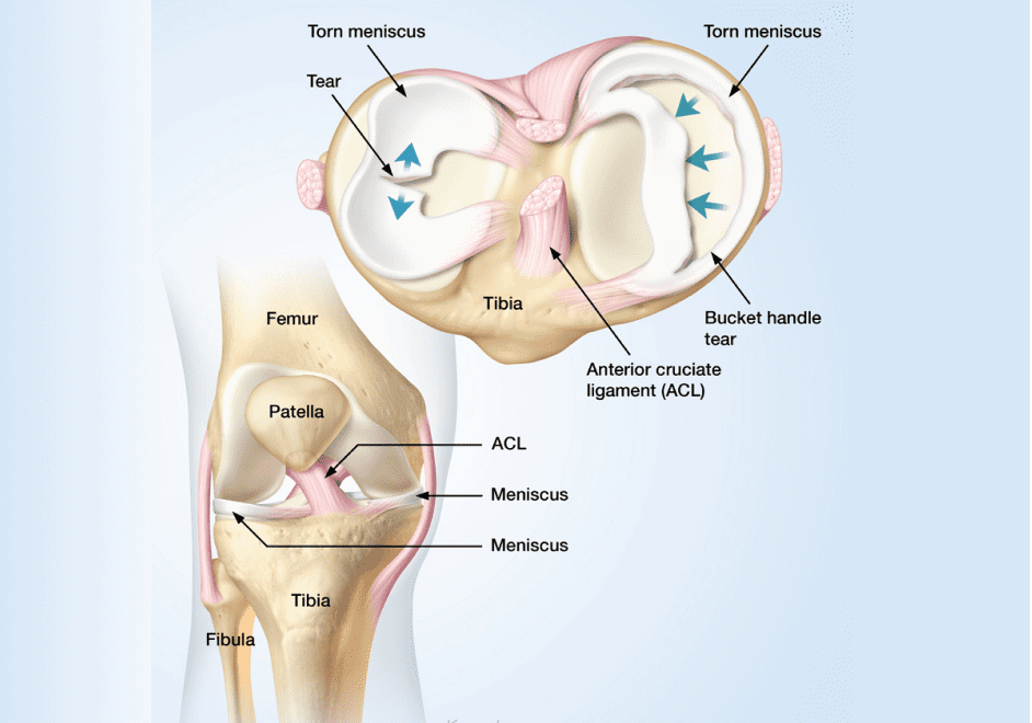 Meniscus Anatomy