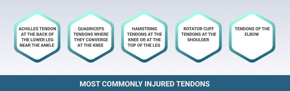 Common Tendon Injuries