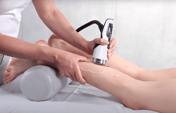 ESWT (Extracorporeal Shock Wave Therapy)