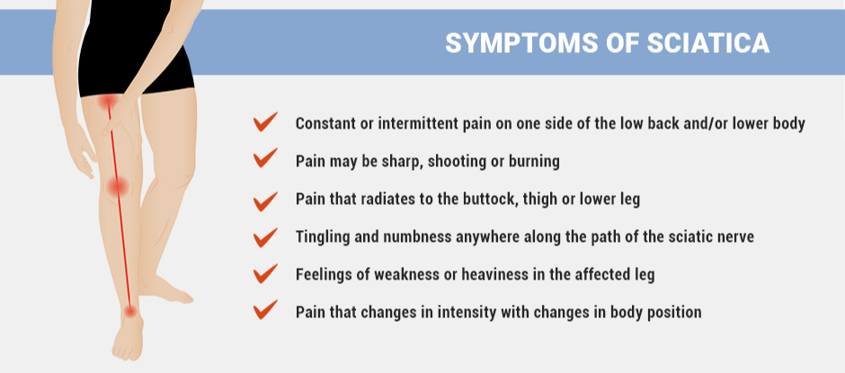 Sciatica Risk and Symptoms