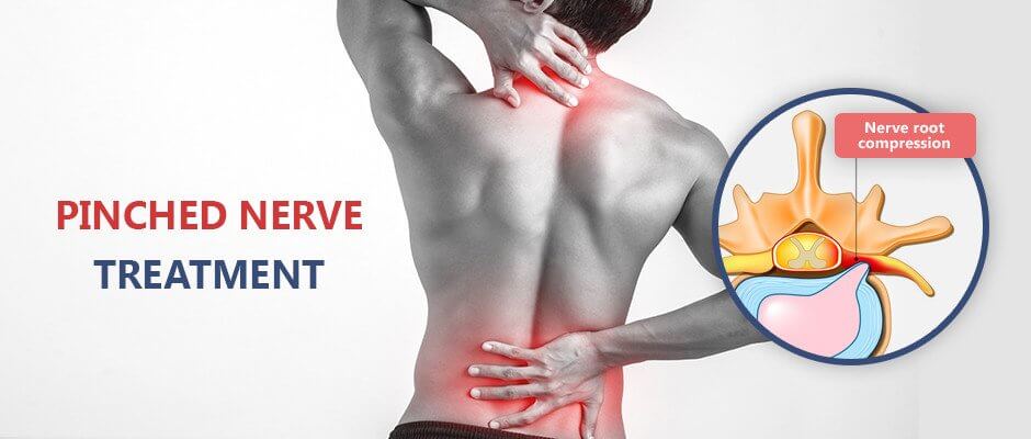 Back Pinched Nerve Treatment Doctor NYC· Sports Injury Clinic