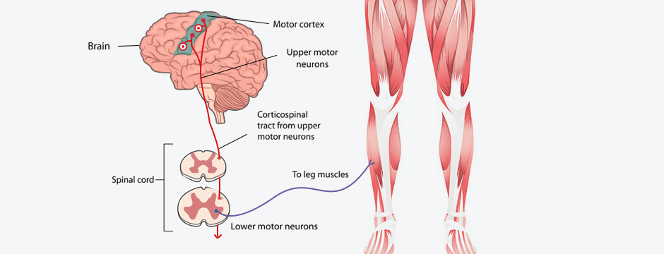 Tendon Pain and the Human Brain 