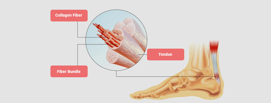 Tendon Pain and the Human Brain 