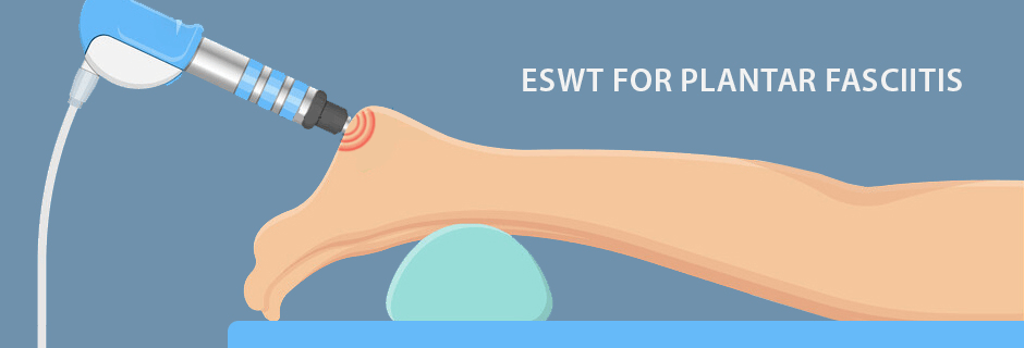 ESWT for Plantar Fasciitis