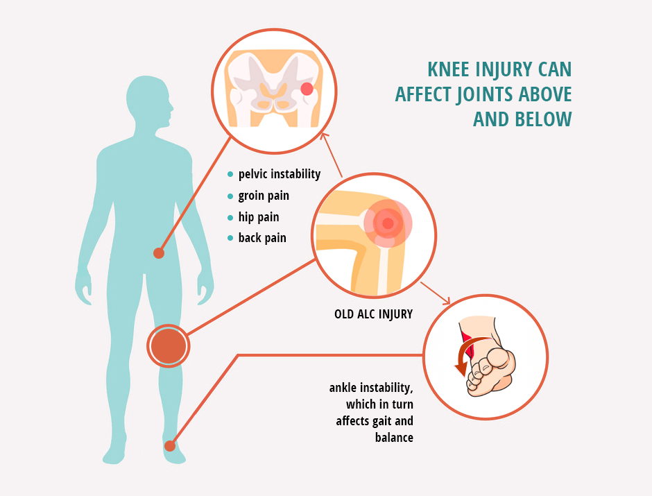 Knee Injuries Affecting the Back