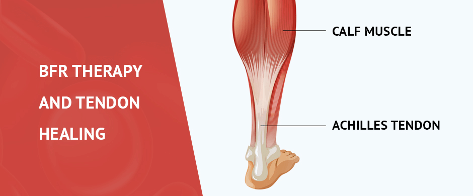 BFR Therapy and Tendon Healing