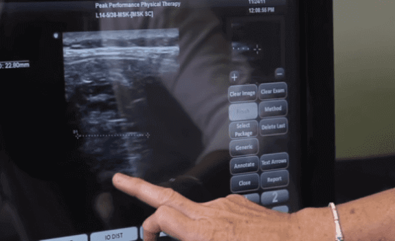 Real-Time Ultrasound Imaging (RUSI)