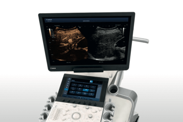 High resolution musculoskeletal ultrasonography