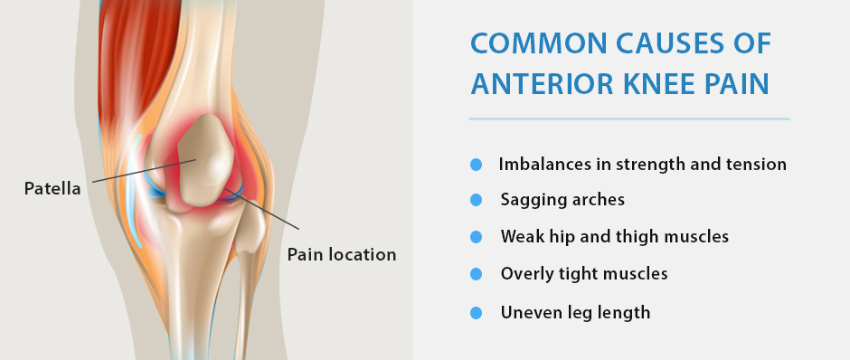 Getting to the Source of Bent Knee Pain - NYDNRehab.com