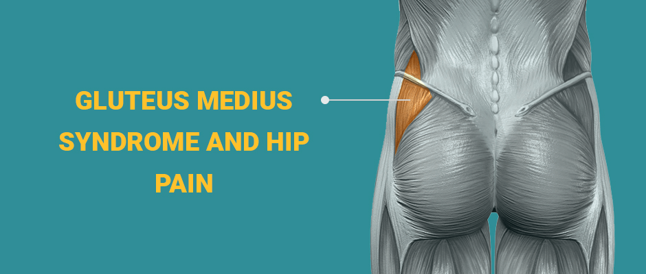 Gluteus Medius Syndrome and Hip Pain