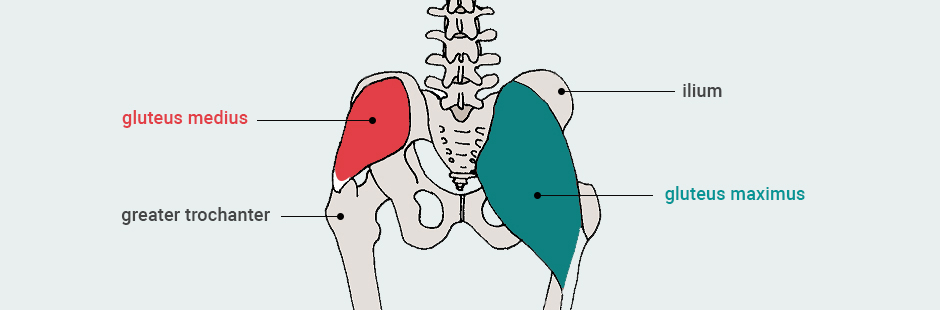 Gluteus Medius Syndrome and Hip Pain 