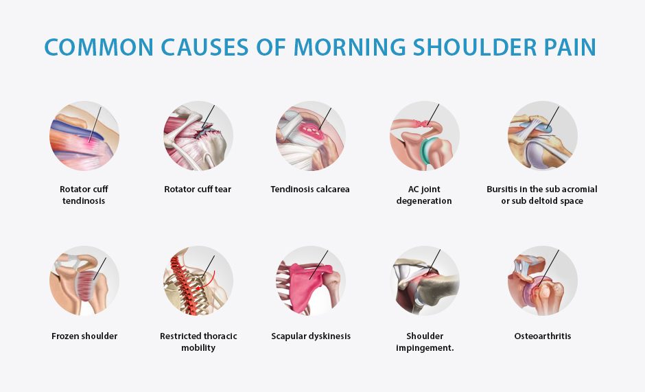 Conditions that Cause Shoulder Pain when Waking Up