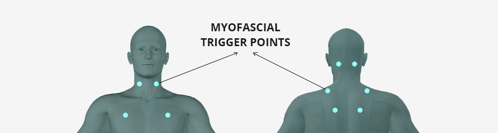 Other Causes of Headaches and Migraines