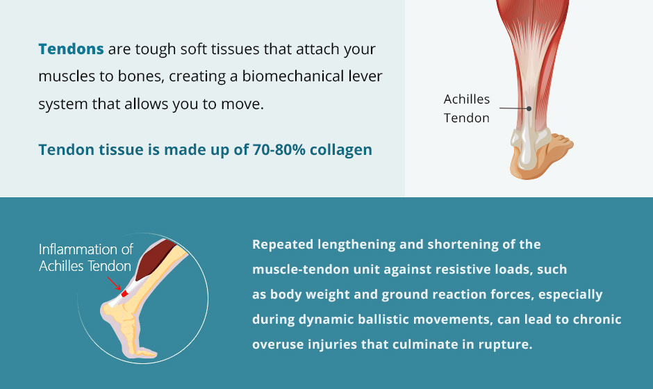 Why Achilles Tendon Injuries Are Slow to Heal