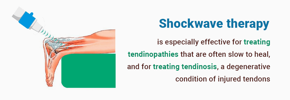What is Shock Wave Therapy and How Does it Work?