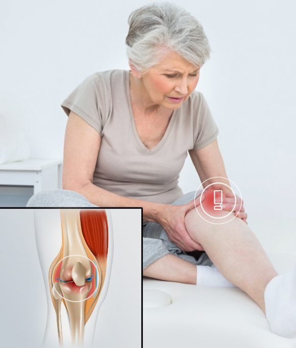 Knee OA Treatment at NYDNRehab vs Conventional Treatment