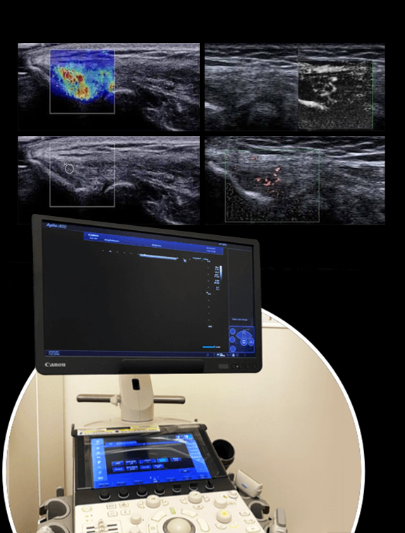 High Resolution Diagnostic Ultrasound Means Accurate Diagnosis and Successful Treatment