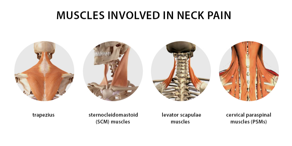 Muscles Involved in Neck Pain