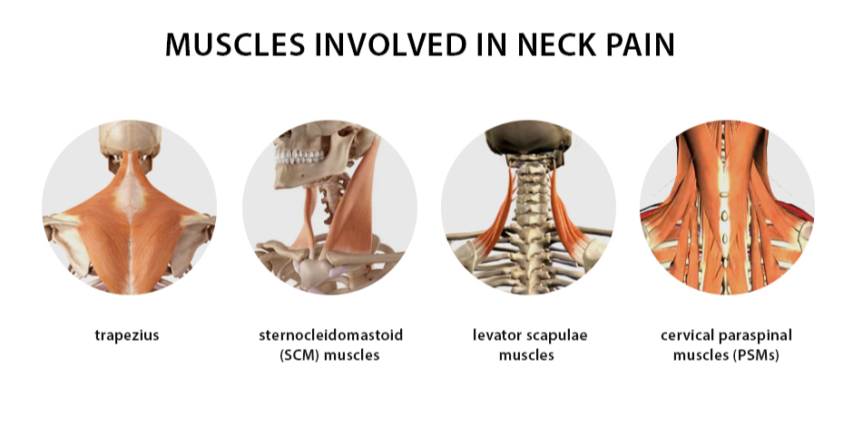 5 stretches that will relieve neck pain and tension