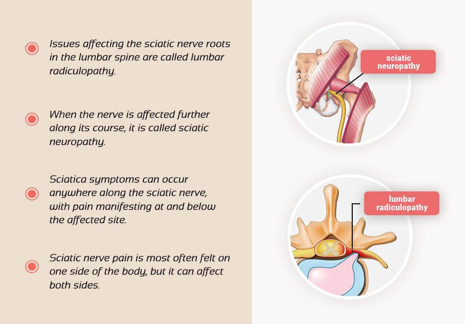 Sciatic Nerve Fast Facts