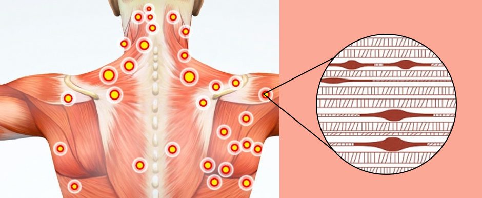 back massage chart of pressure points